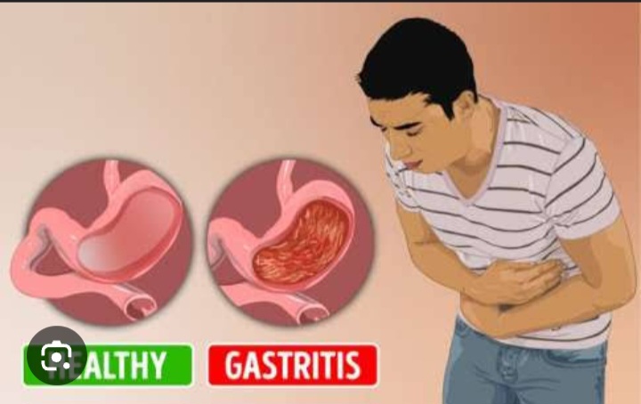 Ini Informasi Penting Aturan Minum Obat Maag