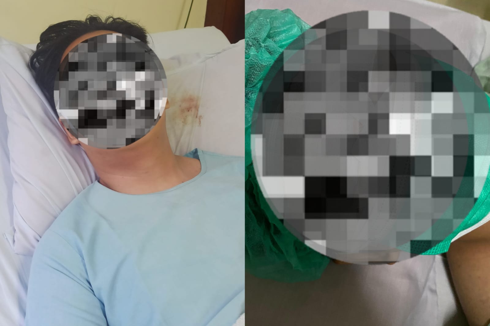 N Alami 14 Jahitan di Muka Akibat Tali Layangan