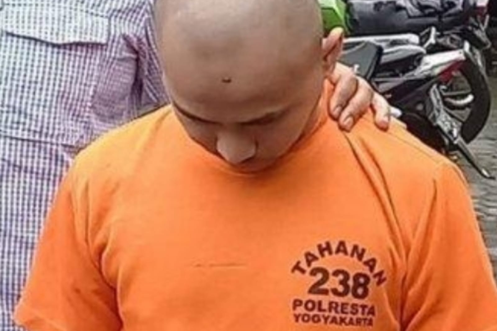 Penyiraman Mahasiswi Asal Ketapang Menggunakan Air Keras di Yogyakarta Dikategorikan Sebagai Kriminal Murni