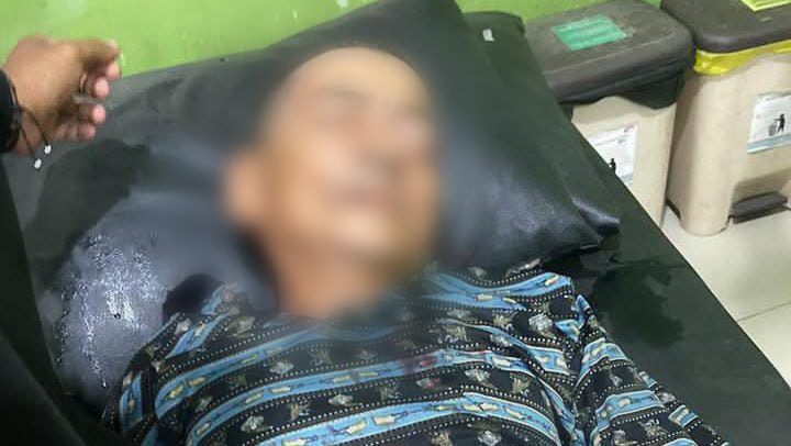 Lansia Korban Tabrak Lari di Tekarang Sambas Meninggal Setelah Dirawat di RS