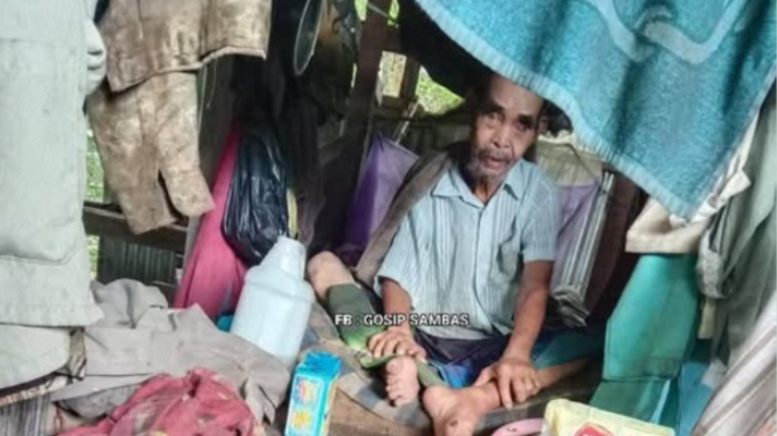 Warga Lumpuh di Sambas Terlantar, Pemkab Dinilai Abai