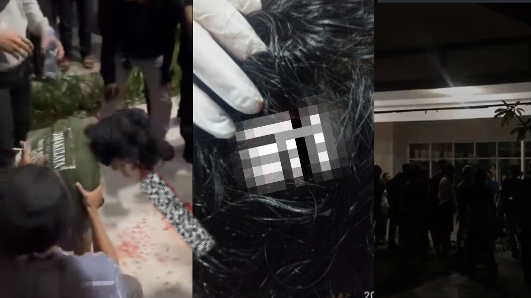 Mahasiswa Untan Diduga Terkena Peluru Karet Saat Aksi di Pontianak, Alami Luka Kepala