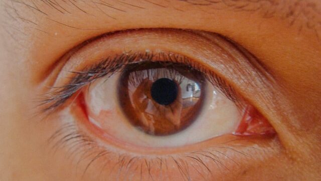 Tak Hanya Tetes Mata! 3 Cara Mengatasi Mata Kering di Rumah Menurut Dokter Spesialis