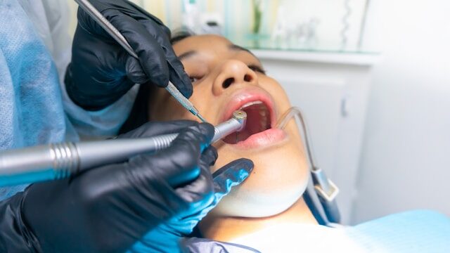 Cuma Gingivitis Akut yang Dijamin! Ini Syarat dan Alur Scaling Gigi Gratis Pakai BPJS
