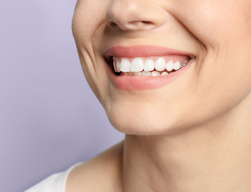 5 Tips Menyamarkan Smile Line agar Wajah Tampak Lebih Muda