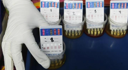 Tes Urine 60 Orang di Rutan Mempawah, Seluruh Sampel Dinyatakan Negatif Narkoba